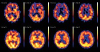 2004-04-depression3