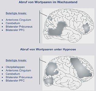 2006-03-hirnforschung3